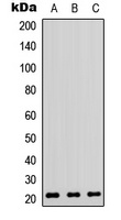 RhoA Rabbit Polyclonal Antibody