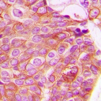 RhoA Rabbit Polyclonal Antibody