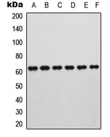 ROR alpha Rabbit Polyclonal Antibody