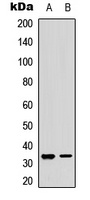 RPA2 (Phospho-S33) Rabbit Polyclonal Antibody