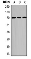 S6K1 (Phospho-T229) Rabbit Polyclonal Antibody