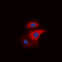 S6K1 (Phospho-T229) Rabbit Polyclonal Antibody