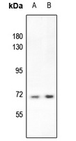 S6K1 (Phospho-T412) Rabbit Polyclonal Antibody