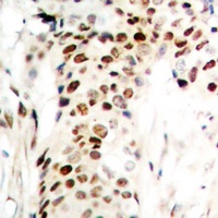 Zep-1 Rabbit Polyclonal Antibody