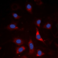 SMAD3 (Phospho-S213) Rabbit Polyclonal Antibody