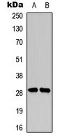 SNAI1 (Phospho-S246) Rabbit Polyclonal Antibody