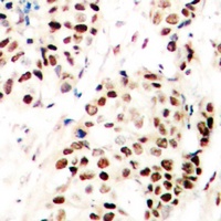 SNAI1 (Phospho-S246) Rabbit Polyclonal Antibody