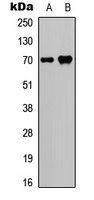 SPHK2 (Phospho-T614) Rabbit Polyclonal Antibody
