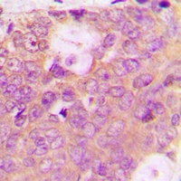 SPHK2 (Phospho-T614) Rabbit Polyclonal Antibody