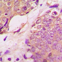 SREBP1 (Phospho-S439) Rabbit Polyclonal Antibody