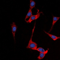 SSTR1 Rabbit Polyclonal Antibody