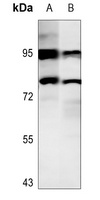 STAT4 (Phospho-Y693) Rabbit Polyclonal Antibody