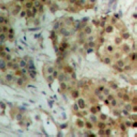 STAT4 (Phospho-Y693) Rabbit Polyclonal Antibody