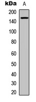 TIE2 (Phospho-Y992) Rabbit Polyclonal Antibody