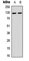 Telomerase (Phospho-S824) Rabbit Polyclonal Antibody