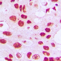 Telomerase (Phospho-S824) Rabbit Polyclonal Antibody