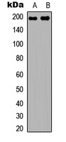 Topoisomerase 2 alpha Rabbit Polyclonal Antibody