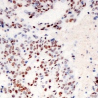Topoisomerase 2 alpha Rabbit Polyclonal Antibody