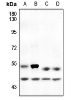 p53 (Phospho-S6) Rabbit Polyclonal Antibody