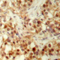 p53 (Phospho-S6) Rabbit Polyclonal Antibody