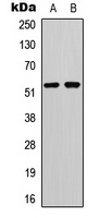 p53 (Phospho-S20) Rabbit Polyclonal Antibody