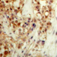p53 (Phospho-S20) Rabbit Polyclonal Antibody