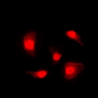 p53 (Phospho-S20) Rabbit Polyclonal Antibody