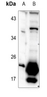 TUSC5 Rabbit Polyclonal Antibody