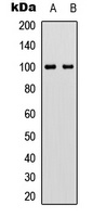 VAV2 (Phospho-Y142) Rabbit Polyclonal Antibody