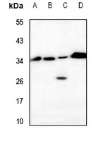 VTI1B Rabbit Polyclonal Antibody