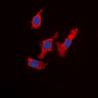 WASF1 Rabbit Polyclonal Antibody
