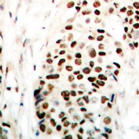 NIPA (Phospho-S354) Rabbit Polyclonal Antibody