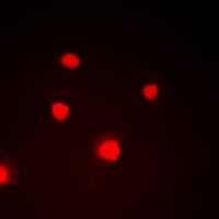 NIPA (Phospho-S354) Rabbit Polyclonal Antibody