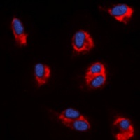 Angiopoietin-1 Rabbit Polyclonal Antibody
