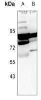 ARHGEF7 Rabbit Polyclonal Antibody