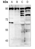 BCL6 Rabbit Polyclonal Antibody