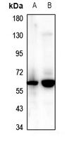 CCZ1 Rabbit Polyclonal Antibody