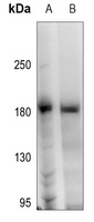 HER2 (Phospho-Y1248) Rabbit Polyclonal Antibody