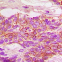 HER2 (Phospho-Y1248) Rabbit Polyclonal Antibody