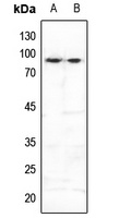 FOXO3 (Phospho-S253) Rabbit Polyclonal Antibody