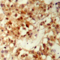 FOXO3 (Phospho-S253) Rabbit Polyclonal Antibody