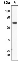 KCNK3 Rabbit Polyclonal Antibody