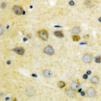 TAK1 (Phospho-T187) Rabbit Polyclonal Antibody