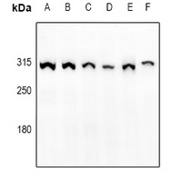 mTOR (Phospho-S2448) Antibody