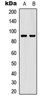STAT5 (Phospho-S726/731) Rabbit Polyclonal Antibody