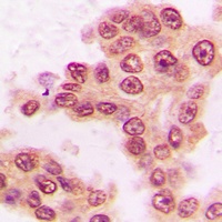 STAT5 (Phospho-S726/731) Rabbit Polyclonal Antibody