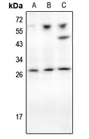 TIMP1 Antibody