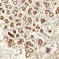 TIMP1 Antibody
