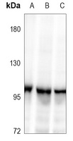 XRN2 Rabbit Polyclonal Antibody