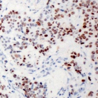 XRN2 Rabbit Polyclonal Antibody